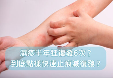【濕疹治療】濕疹半年狂復發逾六次？到底怎樣才可以快速止痕降復發？