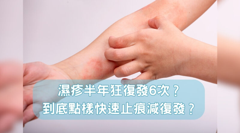 【濕疹治療】濕疹半年狂復發逾六次？到底怎樣才可以快速止痕降復發？